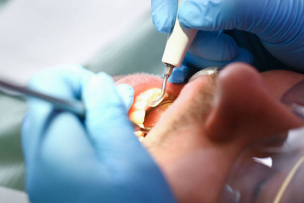 Best Tooth Infection Emergency Dentist  in Hico, TX